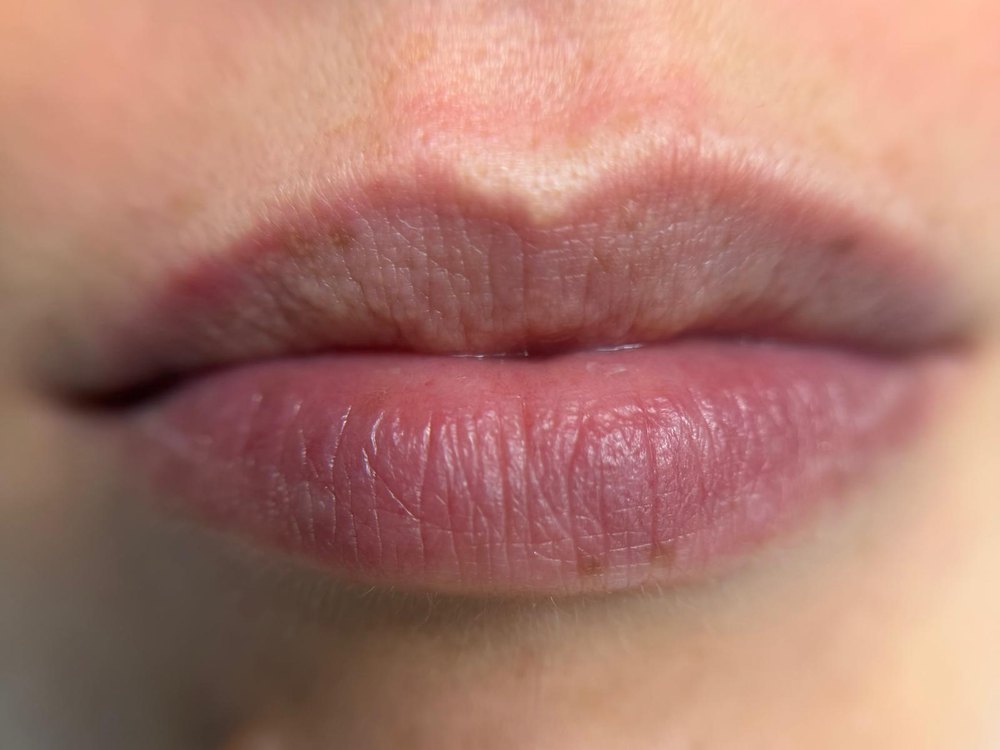 Lèvres candy lips, avant